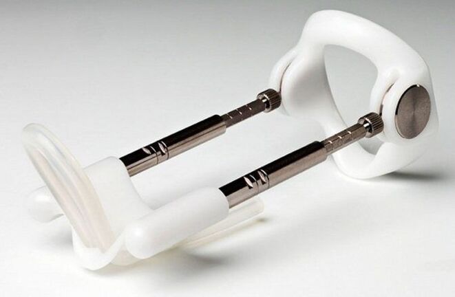 dirêjkirina pênûsê